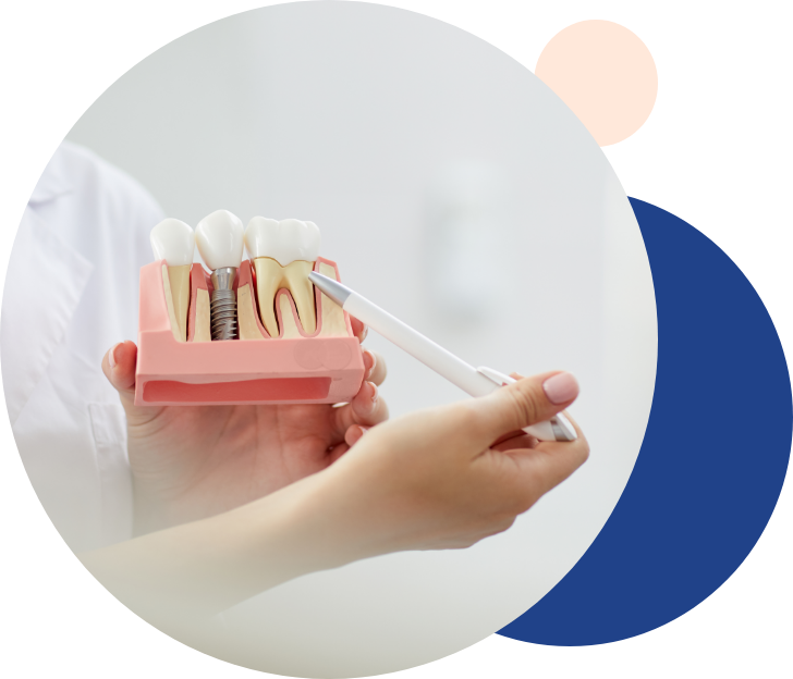 Dental Implant - Tandlægerne Gammel Strand - Group 22 - Dental Implant
