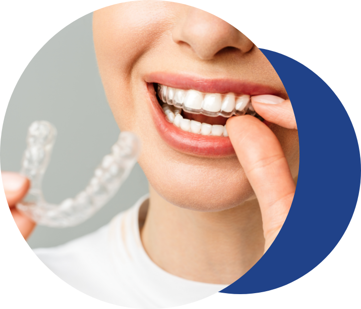 invisalign in Copenhagen - Tandlægerne Gammel Strand - Group 24 - Invisalign Copenhagen