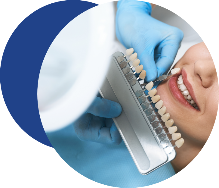 teeth whitening - Tandlægerne Gammel Strand - Group 27 - Teeth Whitening
