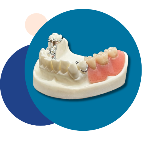 Prosthetic Teeth - Tandlægerne Gammel Strand - Design uden navn 6 - Prosthetic Teeth Prosthetic Teeth - Tandlægerne Gammel Strand - Design uden navn 6 - Prosthetic Teeth