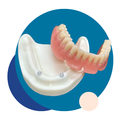 Prosthetic Teeth - Tandlægerne Gammel Strand - Design uden navn 8 1 - Prosthetic Teeth Prosthetic Teeth - Tandlægerne Gammel Strand - Design uden navn 8 1 - Prosthetic Teeth